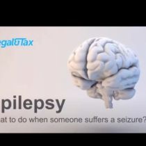 Epilepsy Image